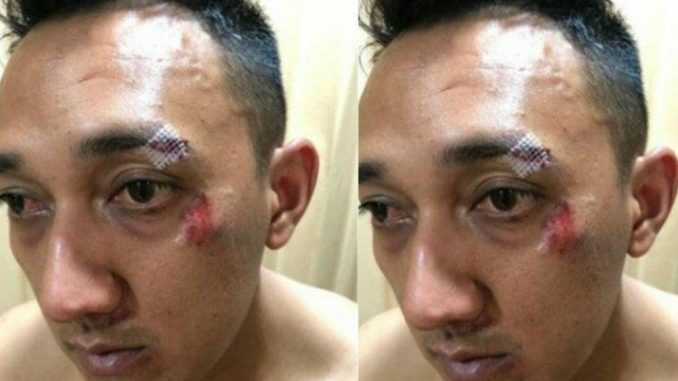 Kapolsek Patumpak AKP Ginanjar Dikeroyok saat Gerebek Bandar Narkoba mengalami luka di kening .