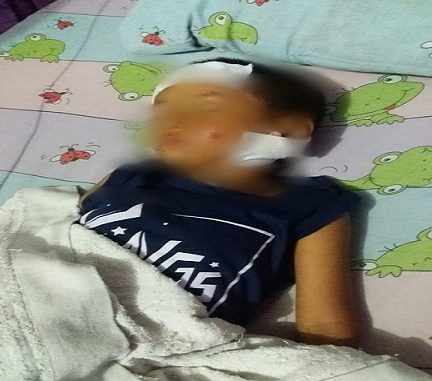 MHD Miko (6) pejalan kaki bertempat tinggal di Dusun II, Desa Karang Tengah,Kec. Serba Jadi, Kab. Serdang Bedagai terpaksa dibawa ke RSU Sri Pamela Tebing tinggi